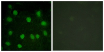 Dematin antibody