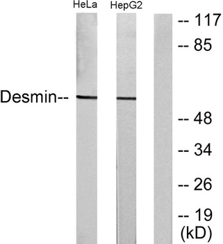 Desmin antibody
