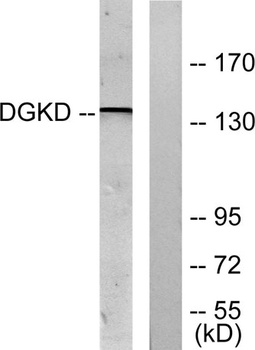 DGK-delta antibody