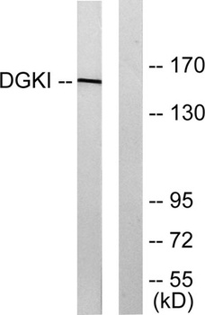 DGK-Î¹ antibody