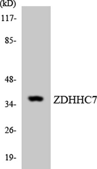 DHHC-7 antibody