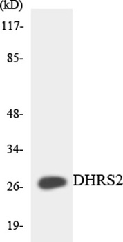 DHRS2 rabbit pAb