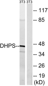DHS antibody