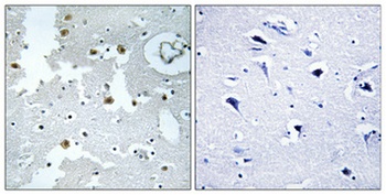 DJ-1 antibody