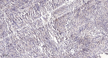 DMGDH antibody