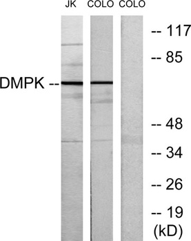 DMPK rabbit pAb