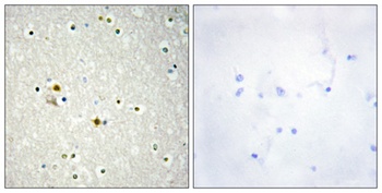 DNA Ligase I rabbit pAb