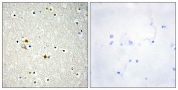 DNA Ligase I antibody