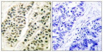 DNA pol β rabbit pAb