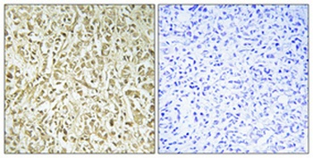 DNA pol λ Polyclonal Antibody