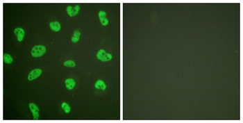 DNA-PKCS antibody