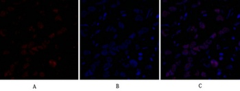 DNMT3B antibody