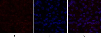 DNMT3B antibody