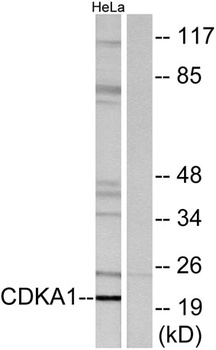 DOC-1 antibody