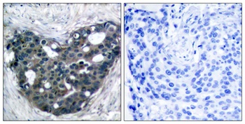 Dok-2 antibody