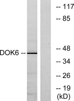 Dok-6 rabbit pAb