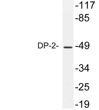 DP-2 antibody