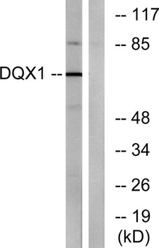 DQX1 antibody