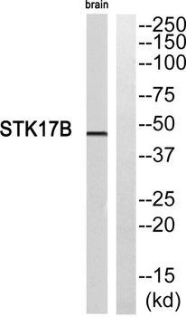 DRAK2 antibody