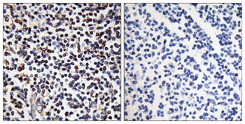 DRAK2 antibody