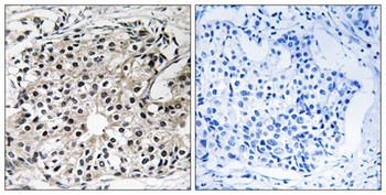 DRS-1 antibody