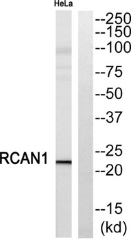 DSCR 1 rabbit pAb