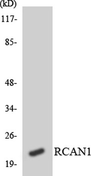 DSCR 1 antibody