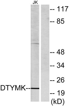 dTMP Kinase rabbit pAb