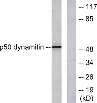 Dynactin 2 antibody