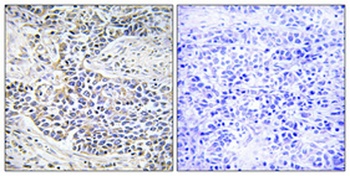 Dynein LC 1 antibody