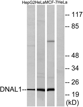 Dynein LC 1 rabbit pAb