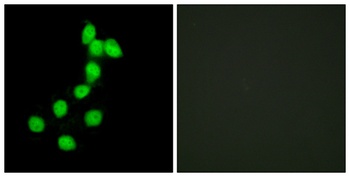 Dyrk1A antibody