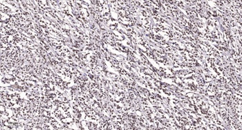 E2F-2 antibody