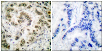 E2F-4/5 antibody