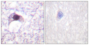 E2F-6 antibody