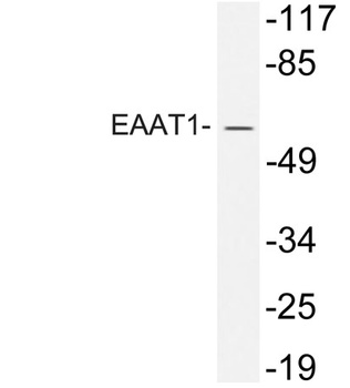 EAAT1 rabbit pAb