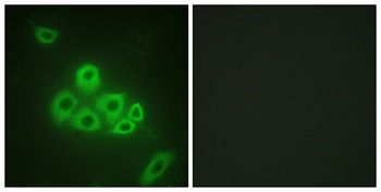 EDG-1 antibody