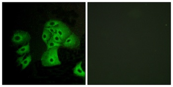 EDG-6 antibody