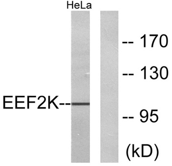 eEF2K antibody
