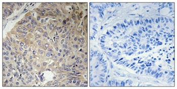 Eg5 antibody