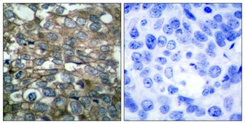 EGFR rabbit pAb