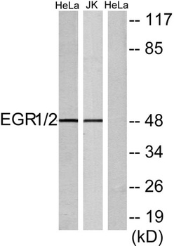 Egr-2 rabbit pAb