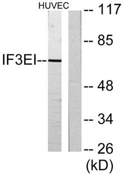 eIF3L rabbit pAb Antibody