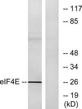 eIF4E rabbit pAb Antibody