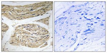 ELOVL1 rabbit pAb