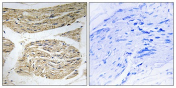 ELOVL1 antibody