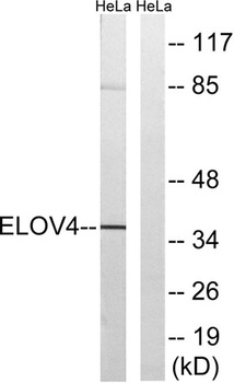ELOVL4 rabbit pAb