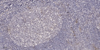 Emp antibody