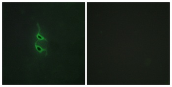 Endo180 rabbit pAb