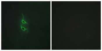 Endo180 antibody